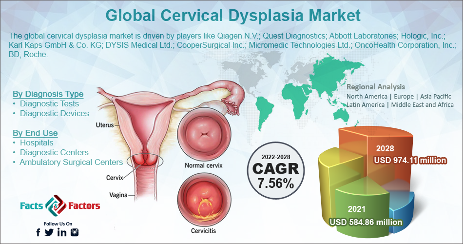Global cervical Dysplasia Market