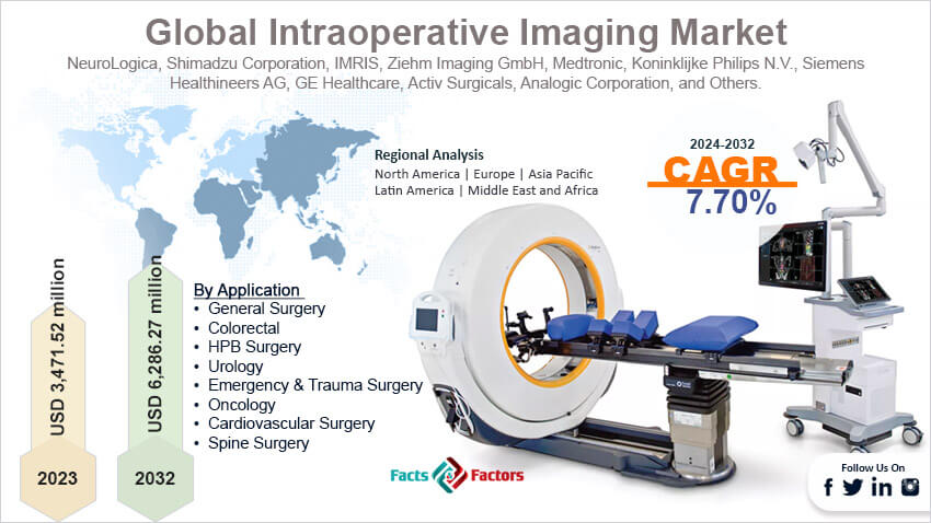 Global Intraoperative Imaging Market