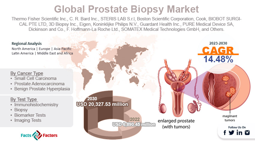global-prostate-biopsy-market-size