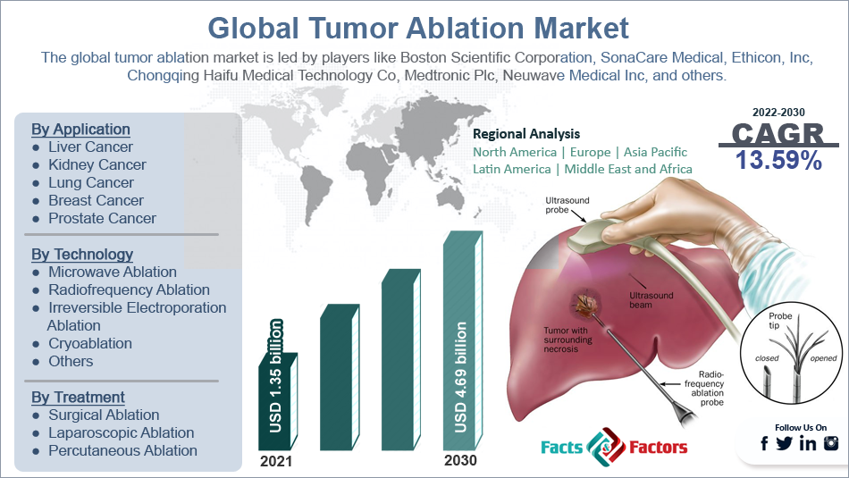 Global Tumor Ablation Market