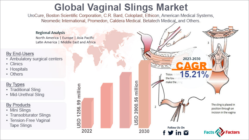 global-vaginal slings market-size